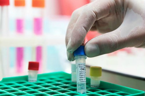 Жители Марий Эл могут бесплатно обследоваться на коронавирус в поликлиниках по месту жительства